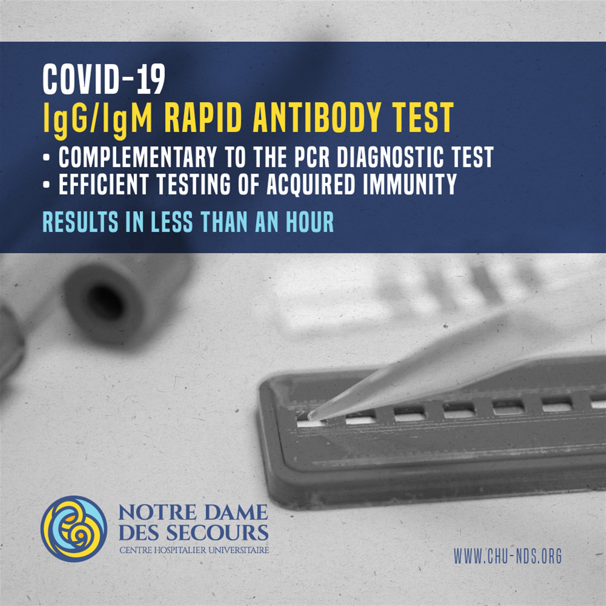 IgG/IgM RAPID ANTIBODY TEST